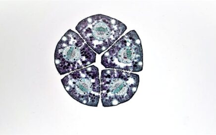 Unlocking Healing: Exploring Stem Cells Therapy in Mexico