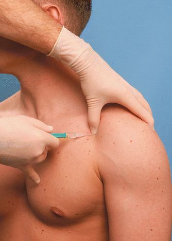 Stem Cell Therapy Long-Term Pain Relief