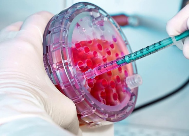 Stem Cell Mexico: Your Complete Guide to Regenerative Medicine Stem Cell Mexico: Your Complete Guide to Regenerative Medicine