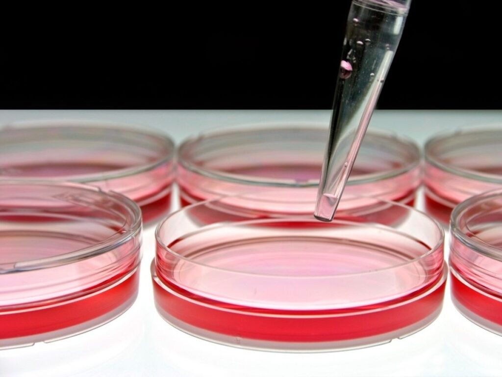 Stem Cell Therapy Success Rates: How to Interpret the Evidence