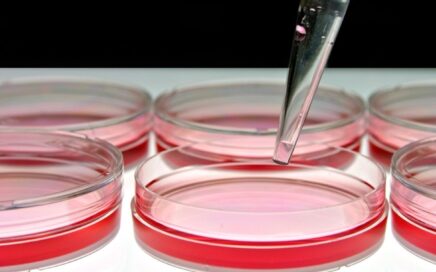 Stem Cell Therapy Success Rates: How to Interpret the Evidence