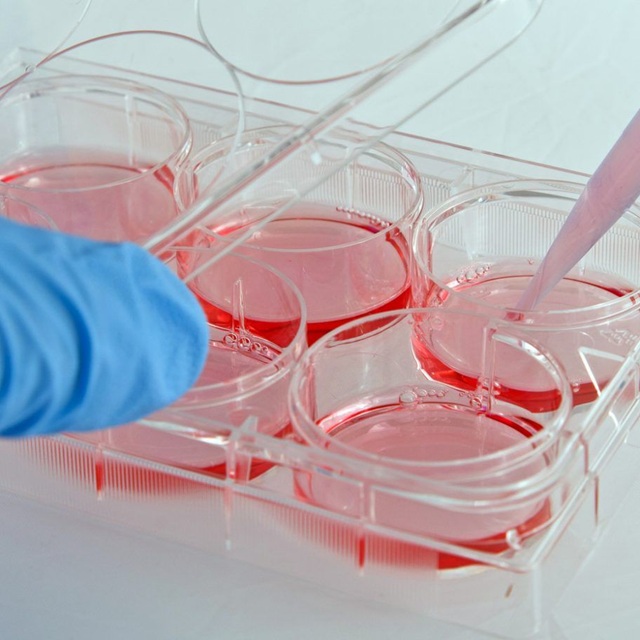 How to Evaluate Stem Cell Treatment Claims How to Evaluate Stem Cell Treatment Claims